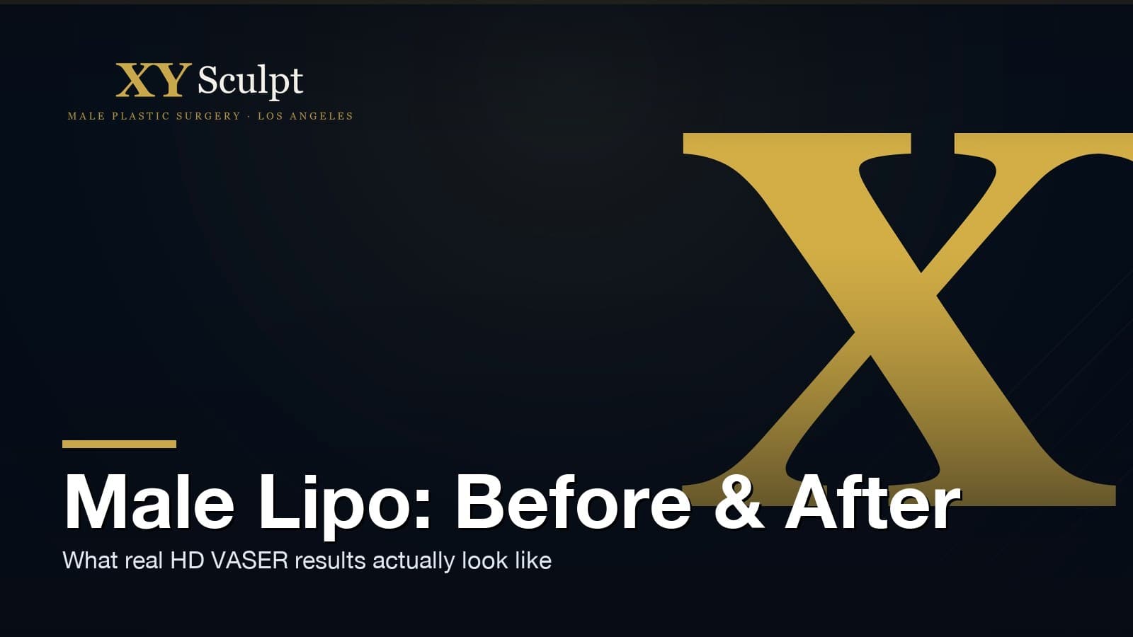 Male Liposuction Before and After: What Real Results Look Like